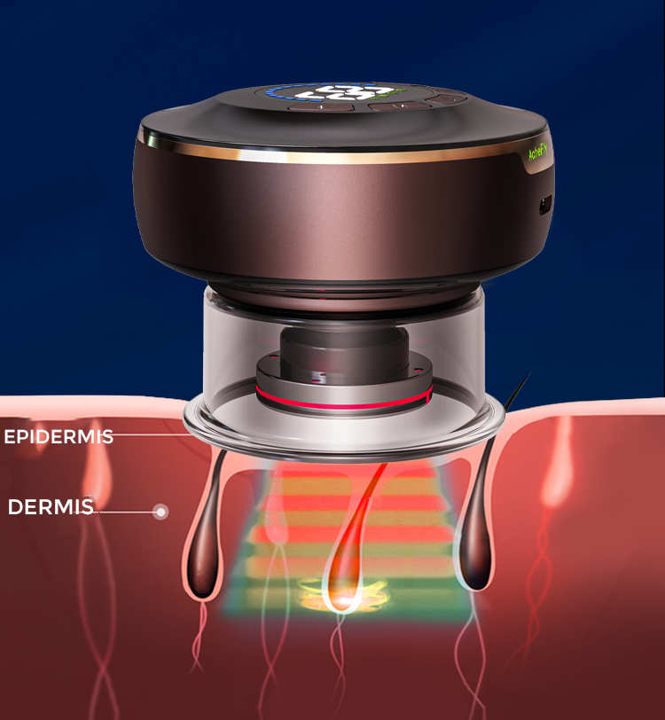 AcheFly Multifunctional Cupping Moxa Device